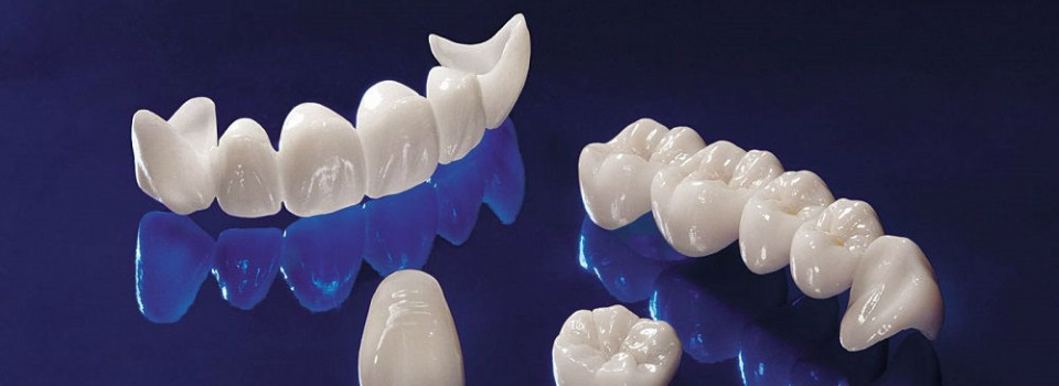 Crowns and Bridges | Family Dental Care