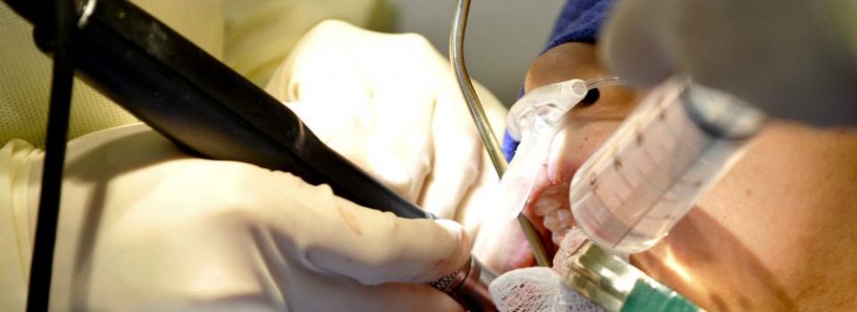 Oral Surgery | Family Dental Care